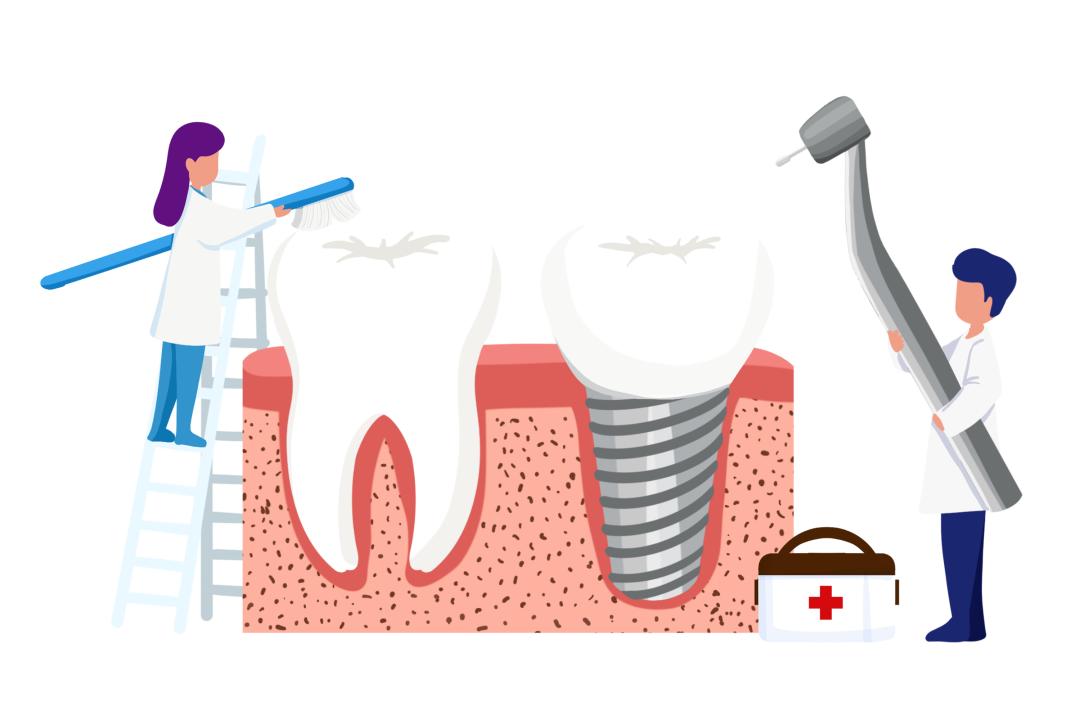 牙齿松了要怎么解决,牙齿松了有什么办法补救