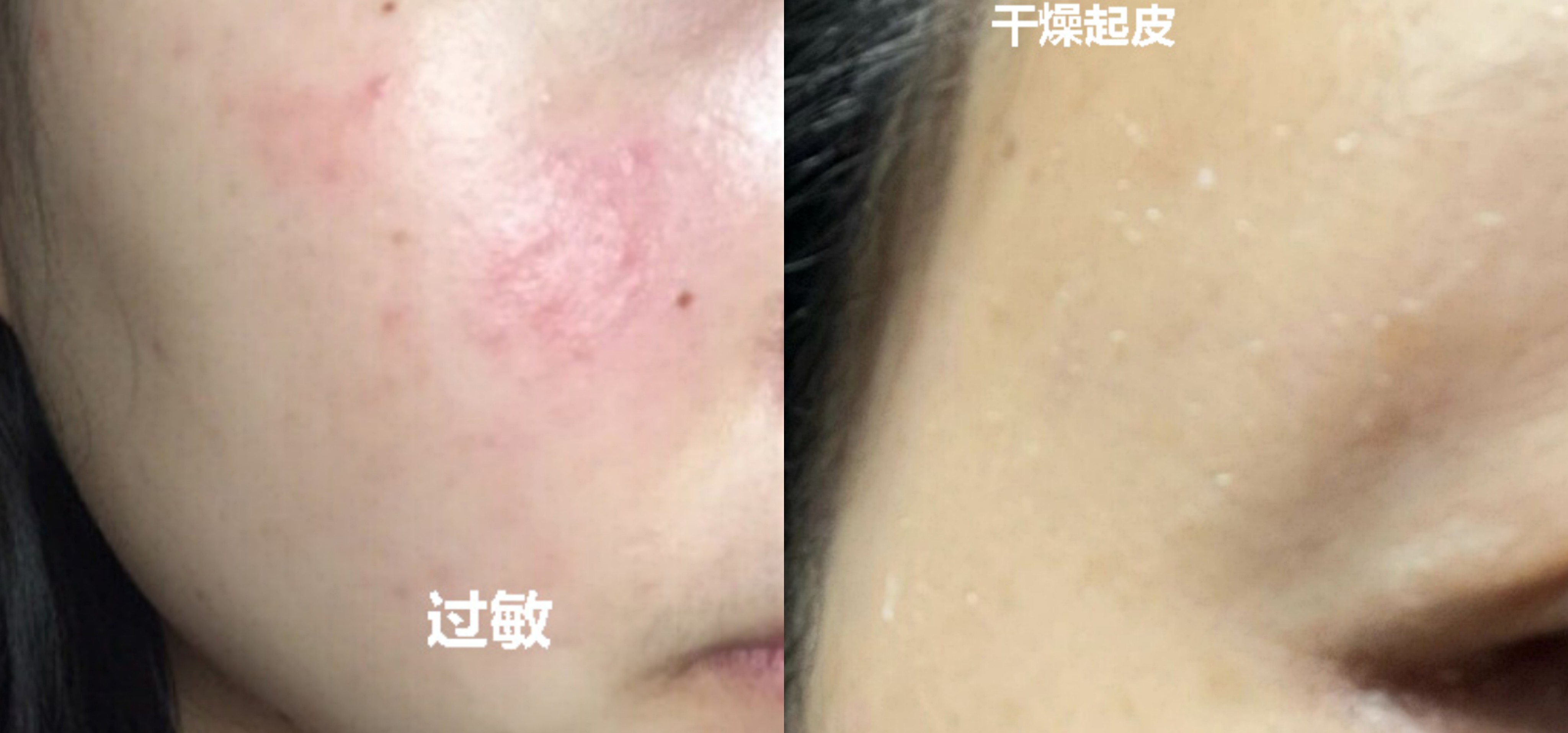 公认好用的4款孕妇保湿水乳:悦木之源,芙丽丝芳均上榜,你的呢