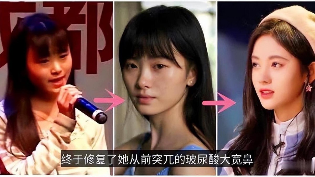 因整容毁掉前途的女星,整容改命的五位明星