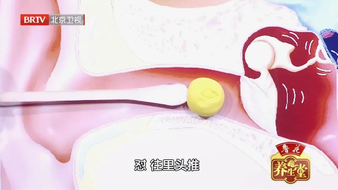 我国神经性耳鸣发病率,我国耳鸣患者已超1亿