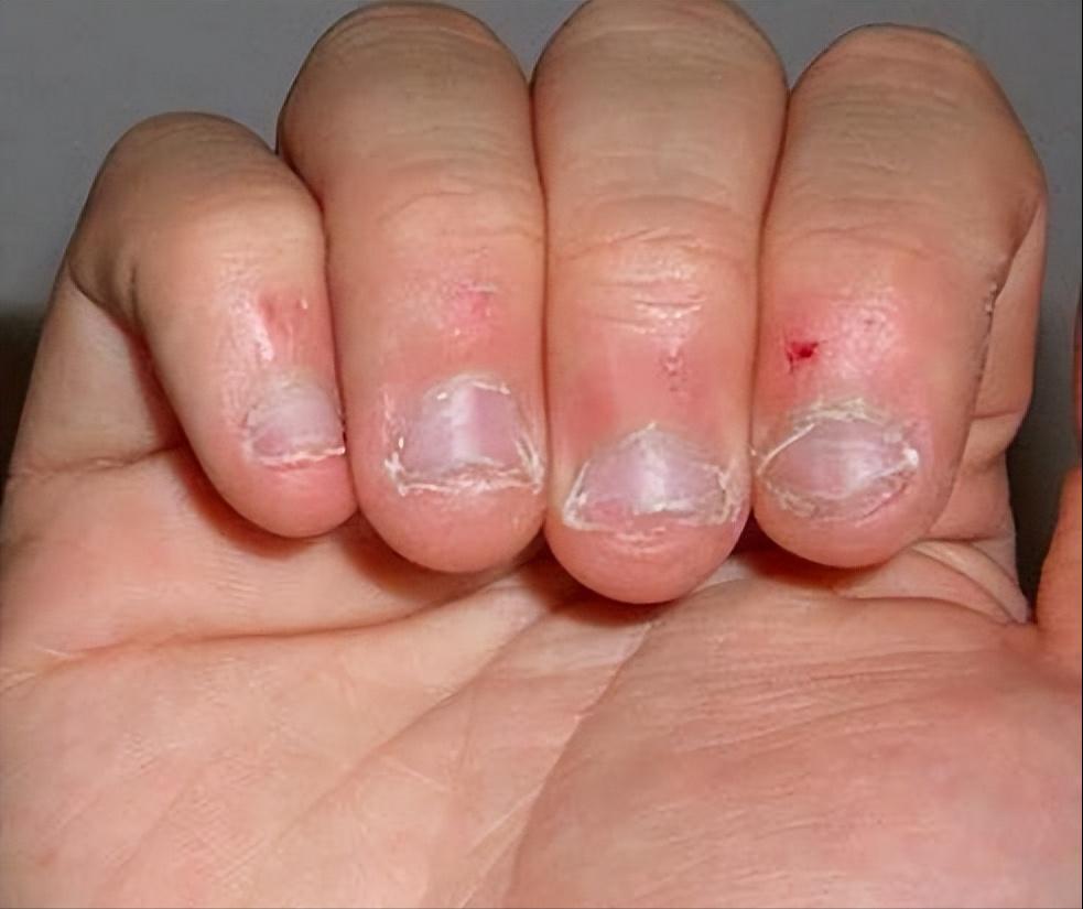 如何帮助孩子改掉啃手指的习惯,8岁儿童老用嘴啃手指是什么原因