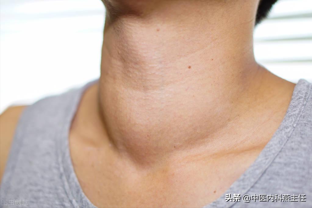 桥本甲状腺结节甲亢应该注意什么,桥本甲状腺结节伴有甲亢怎样治疗