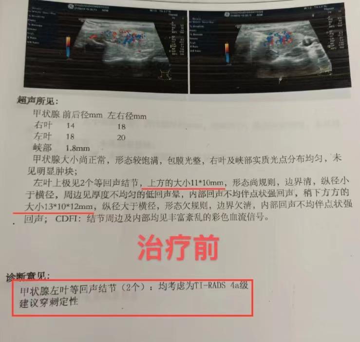 人的生长激素是由甲状腺分泌的吗,甲状腺激素由什么器官分泌