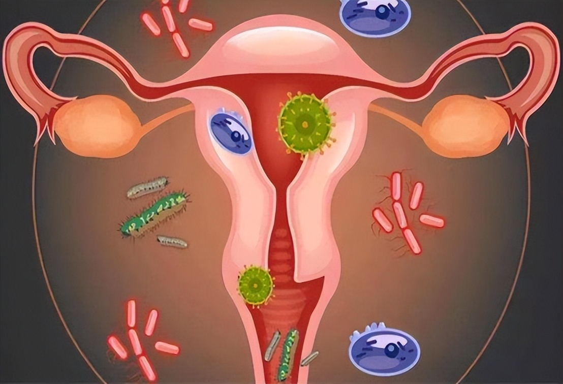 外阴肥大有必要手术吗,外阴肥大需不需要做手术