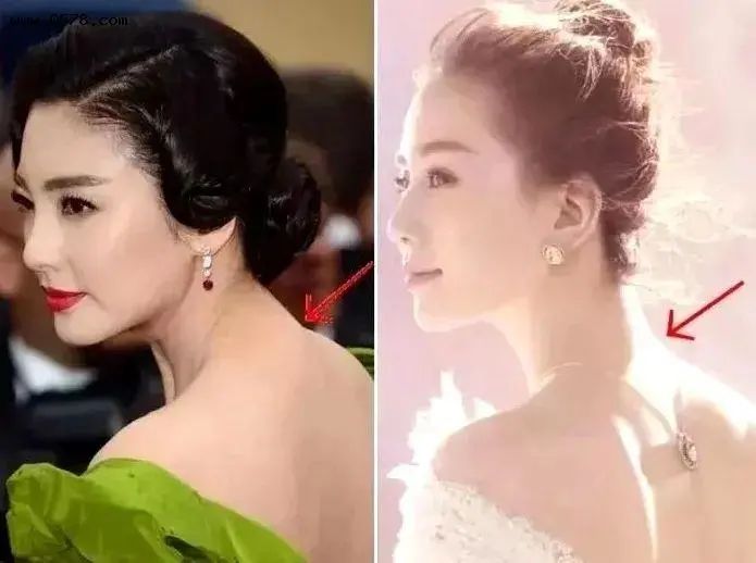 现代人许多都有“富贵包”,点进来教你怎么办(建议收藏)