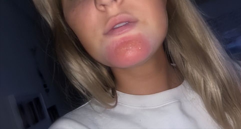 澳洲妹子和男友接吻,澳大利亚女子与男友接吻