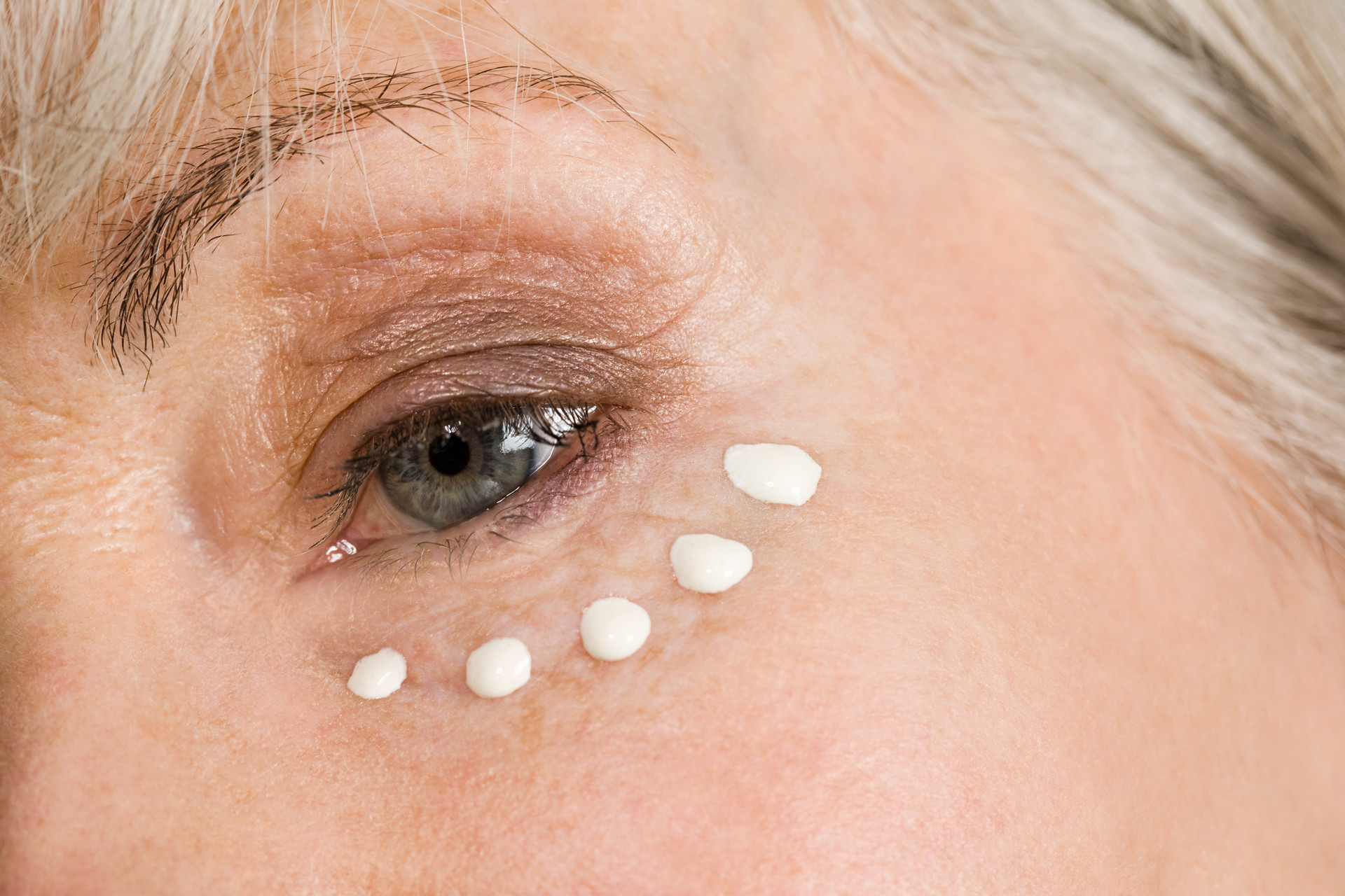 眼周皱纹多怎么消除,用维a酸乳膏涂眼出现皱纹怎么办