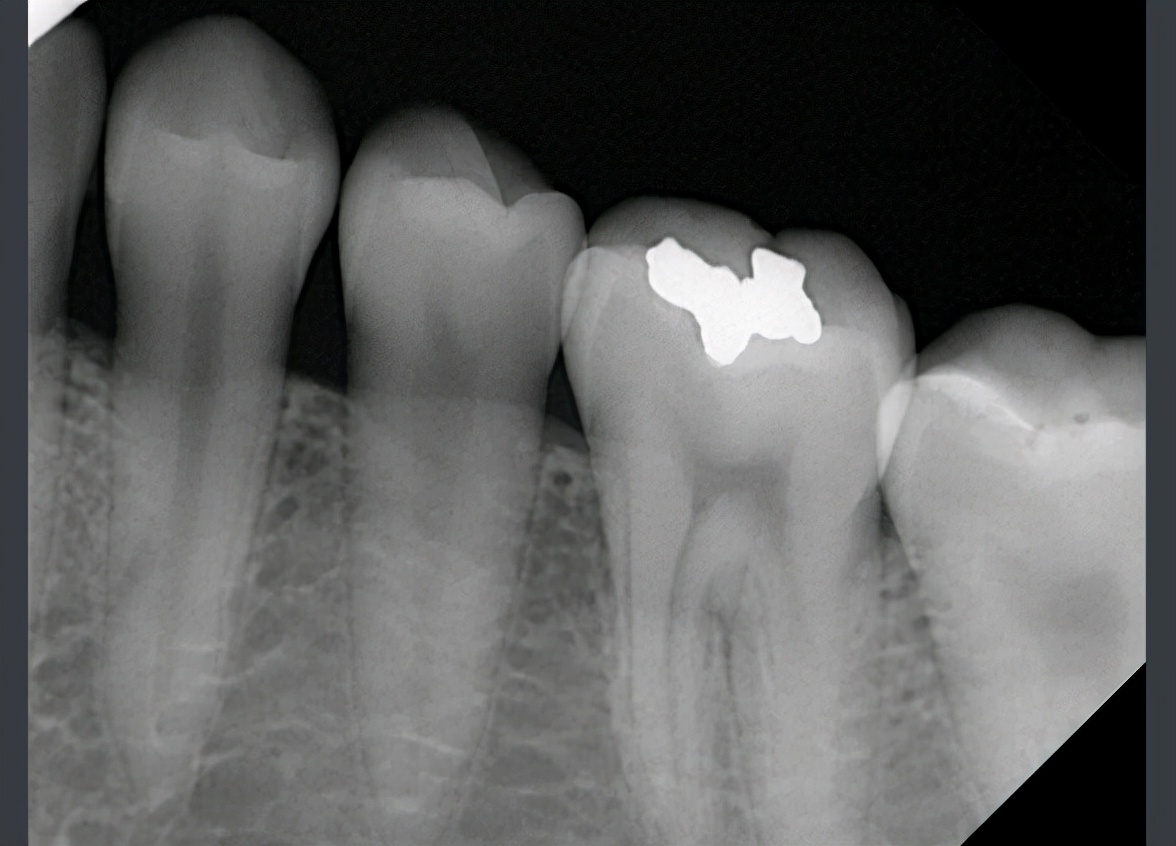 三星屏下光线感应器,三星sensor是测试什么的