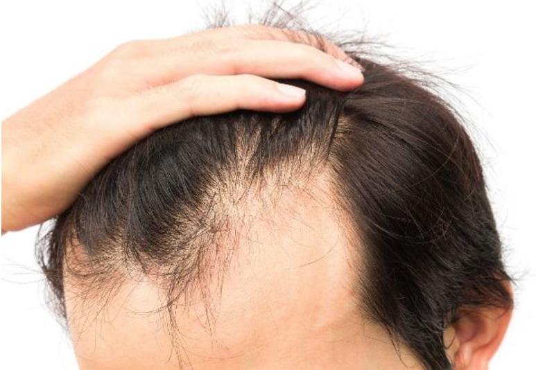 好物推荐生姜防脱洗发水,洗发水推荐生姜防脱控油袋装