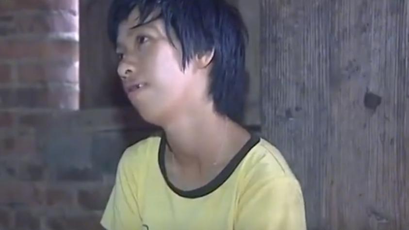 广东罕见双性人,广东出现罕见双性人