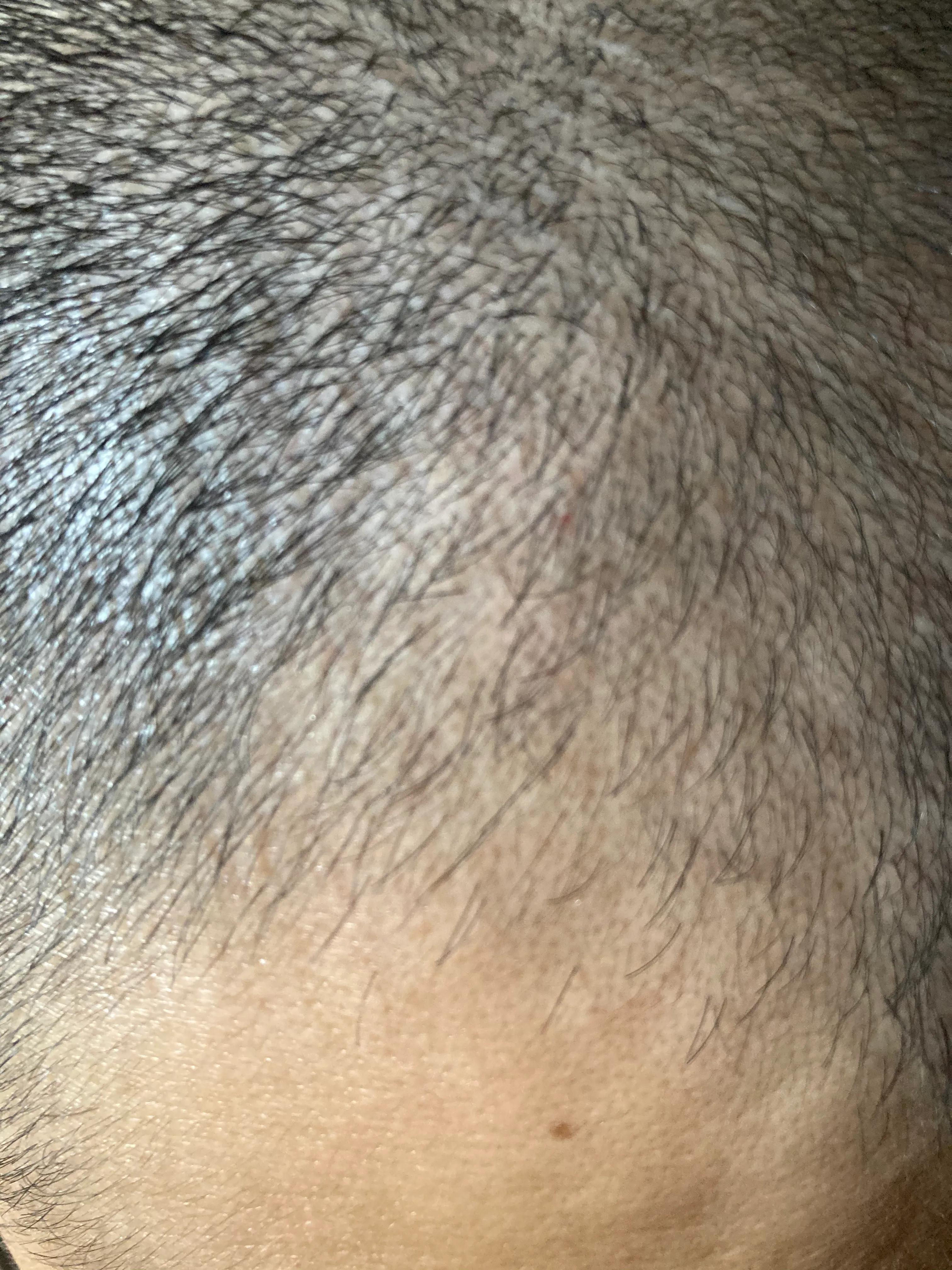 都说生姜能生发到底怎么用最合理,生姜生发的真实记录