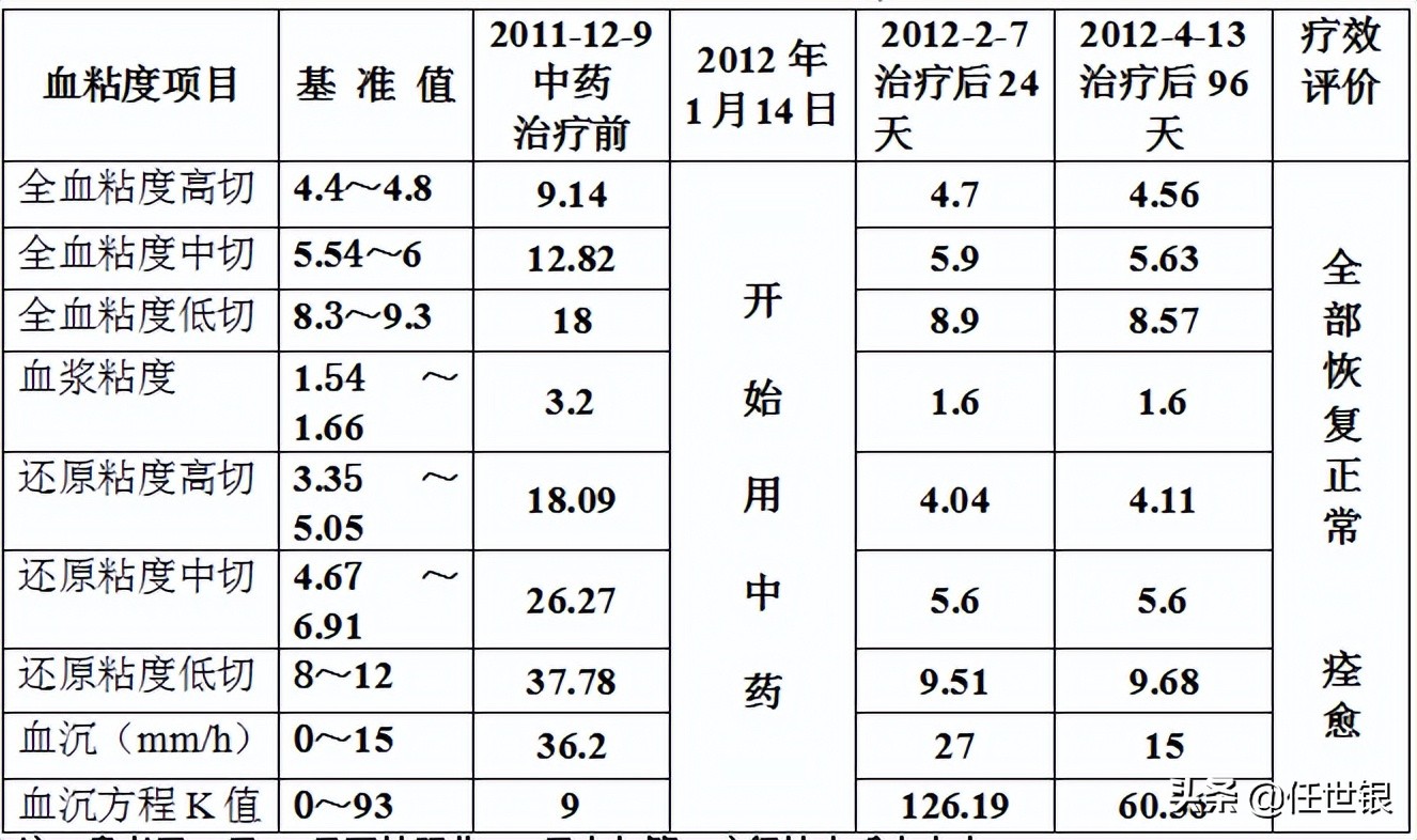 中西医结合治疗心肌梗死案例,心血管疾病中西医结合治疗