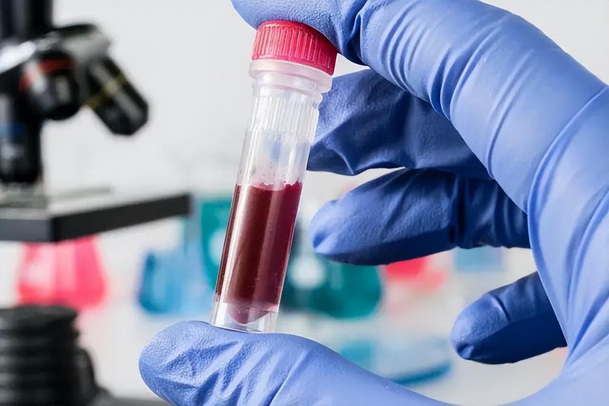 血常规炎性指标明显升高,新生儿血常规各项指标升高