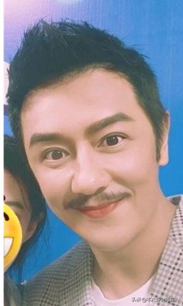 哪个女明星整容脸部变僵硬,整容脸vs自然脸的明星老去