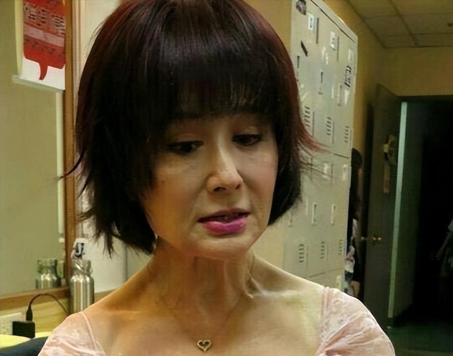 面部衰老皱纹解剖图,面部皱纹衰老对比图