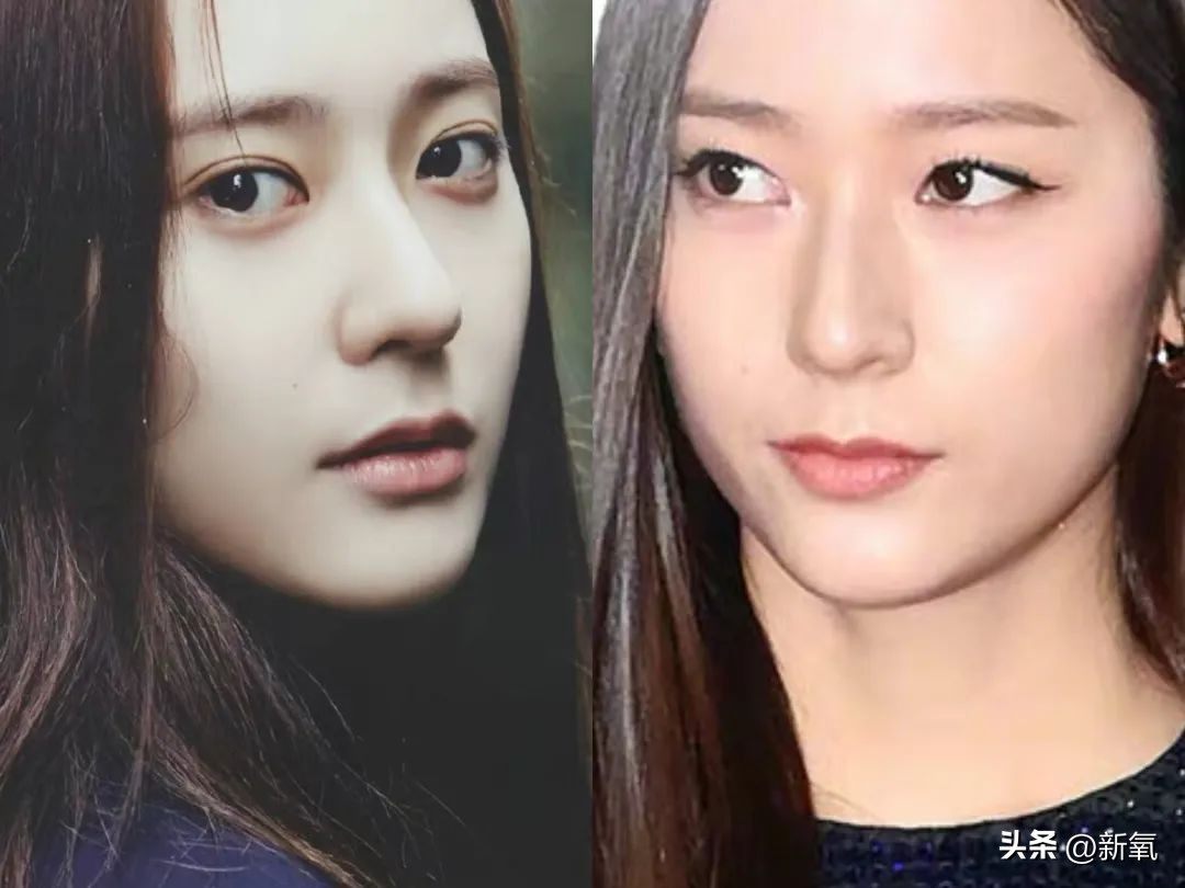 嘴唇薄变丰满,嘴唇变凸变丑怎么办