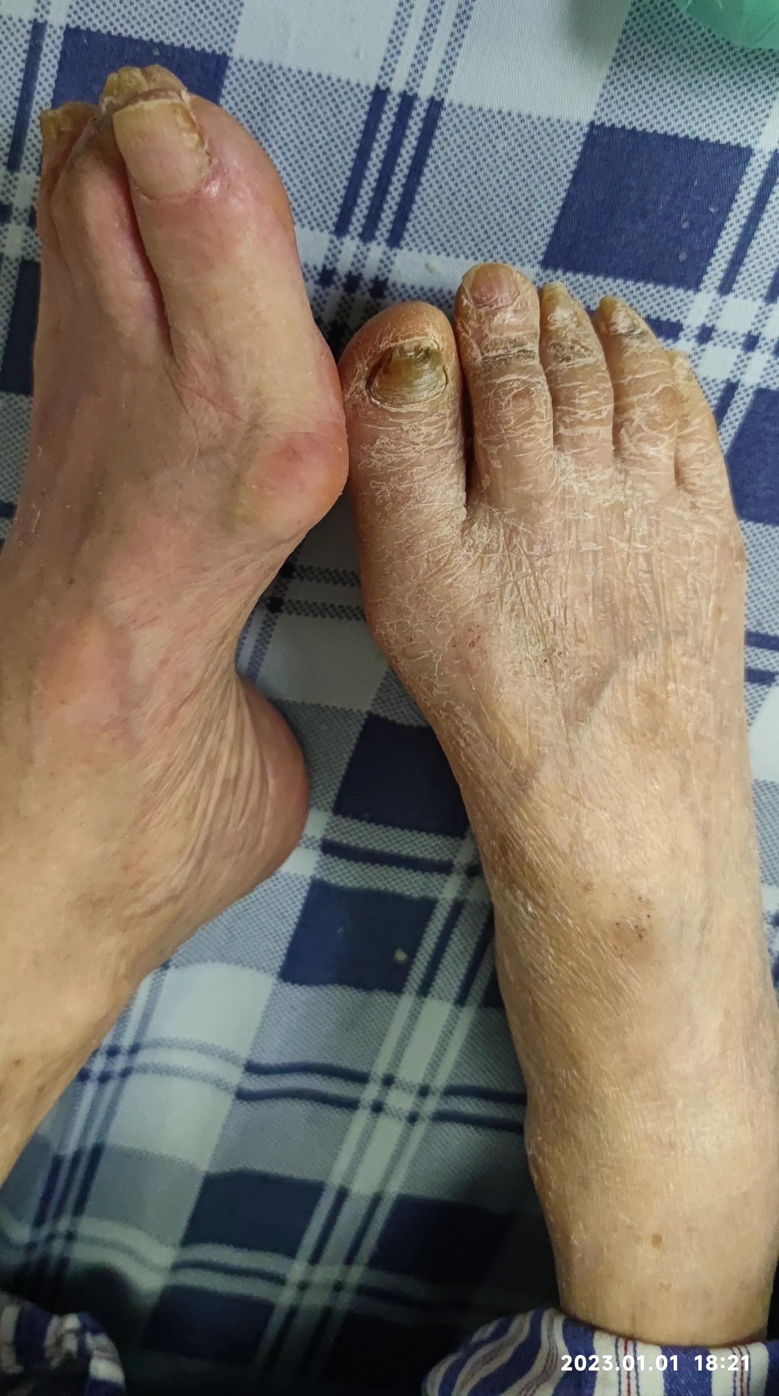 ICU之揪心的求医历程