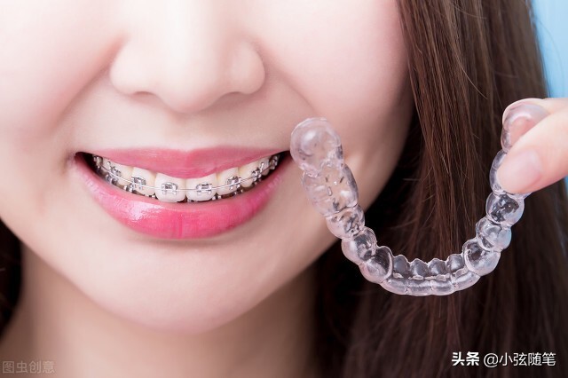 隐形矫正牙齿一万多,牙齿矫正和隐形牙齿矫正的全过程