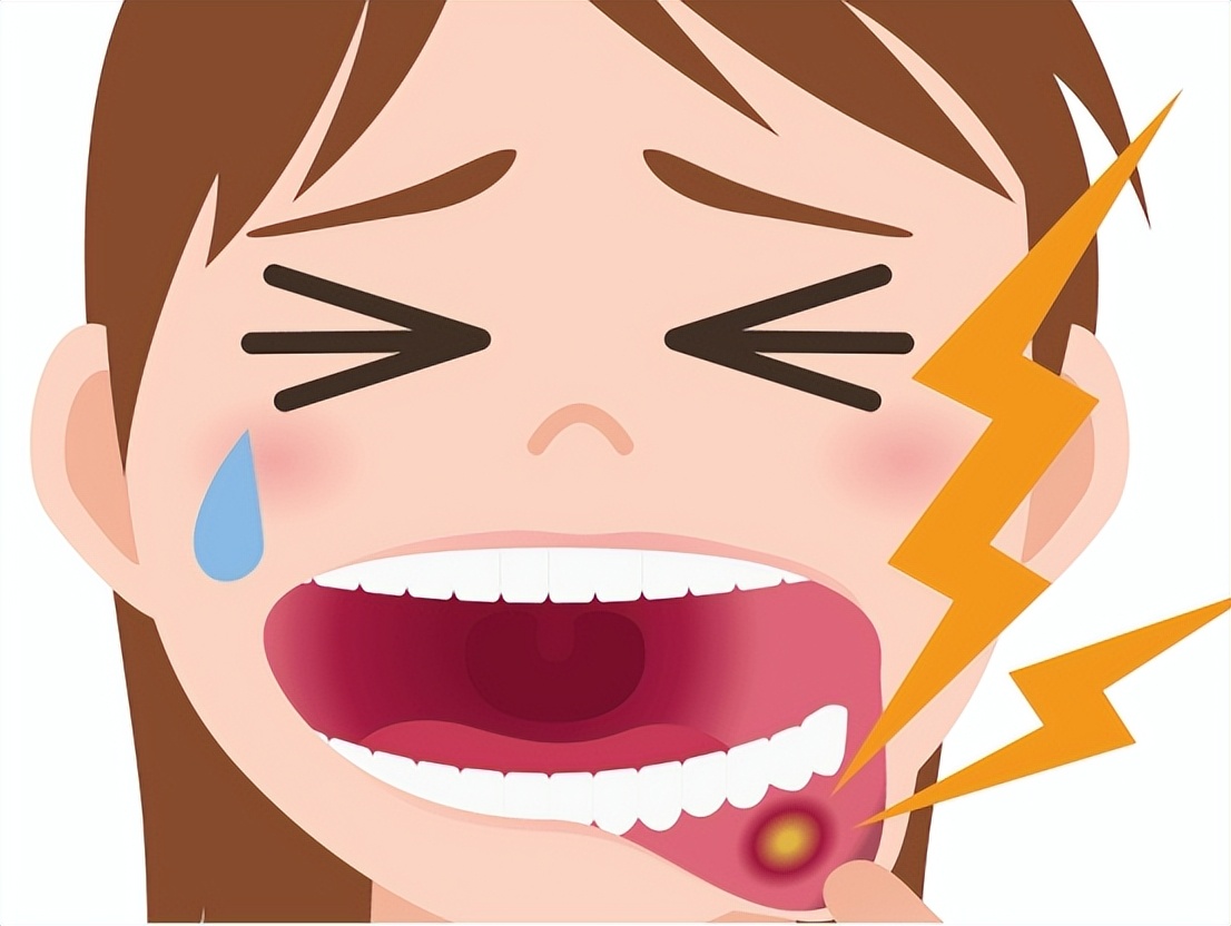 小儿口疮怎么治好得快,小儿长口疮是怎么回事