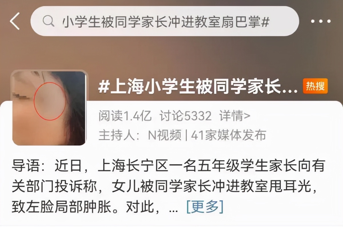 7岁女孩满脸血印竟是因为这件小事，孩子之间经常发生