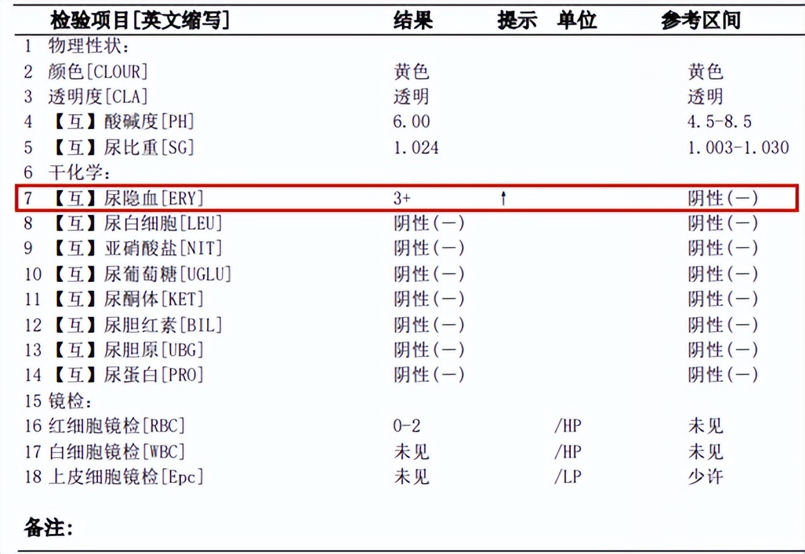 月经期间体检会出现尿隐血阳性吗,体检尿隐血阳性3+挂什么科复查