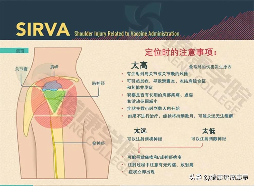 注射疫苗后的肩部疼痛