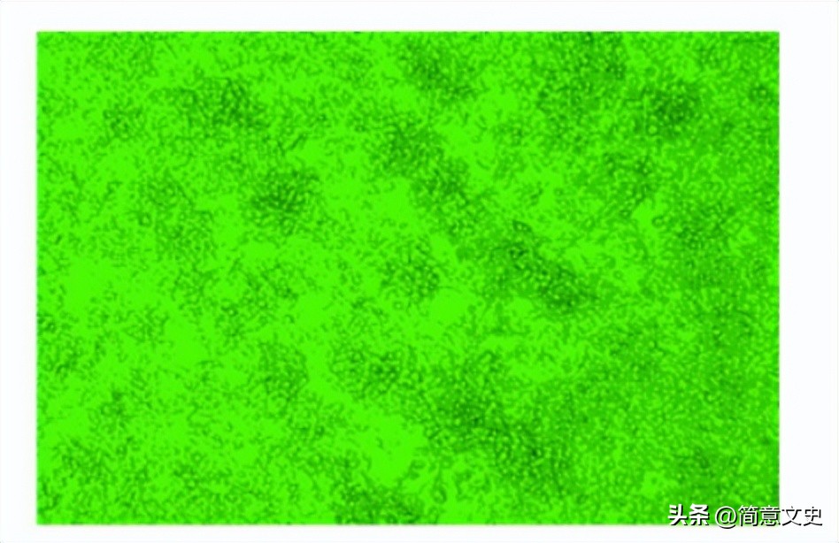 绿色荧光蛋白基因的克隆,绿色荧光蛋白在基因工程的作用