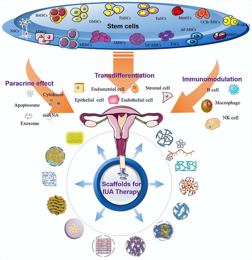 临床适应症｜干细胞对于薄型子宫内膜的修复作用及其临床意义