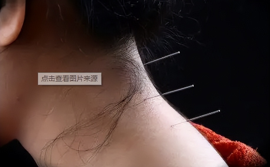 中医经络按摩机器人,针灸机器人