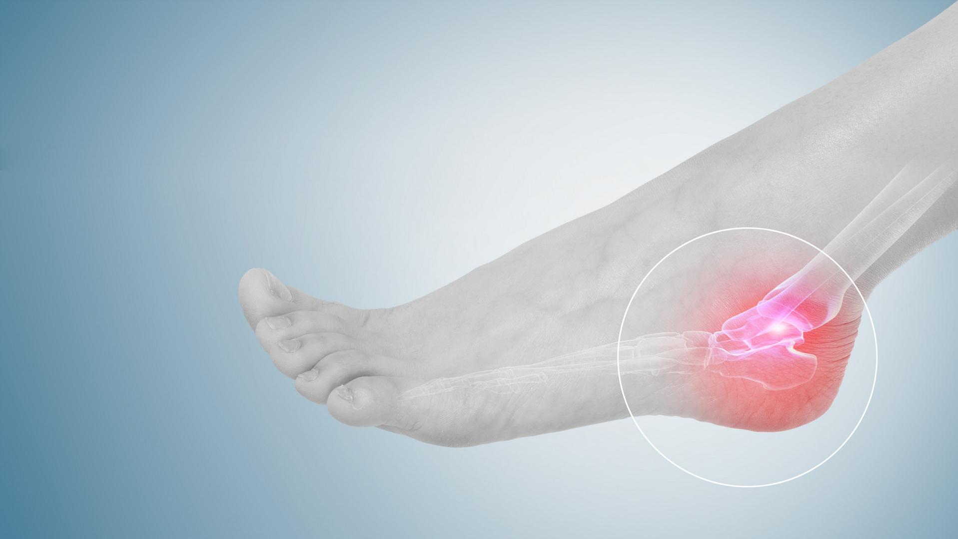 68岁老人这几天突然脚后跟肿痛,老人脚后跟脱皮后胀痛怎么回事