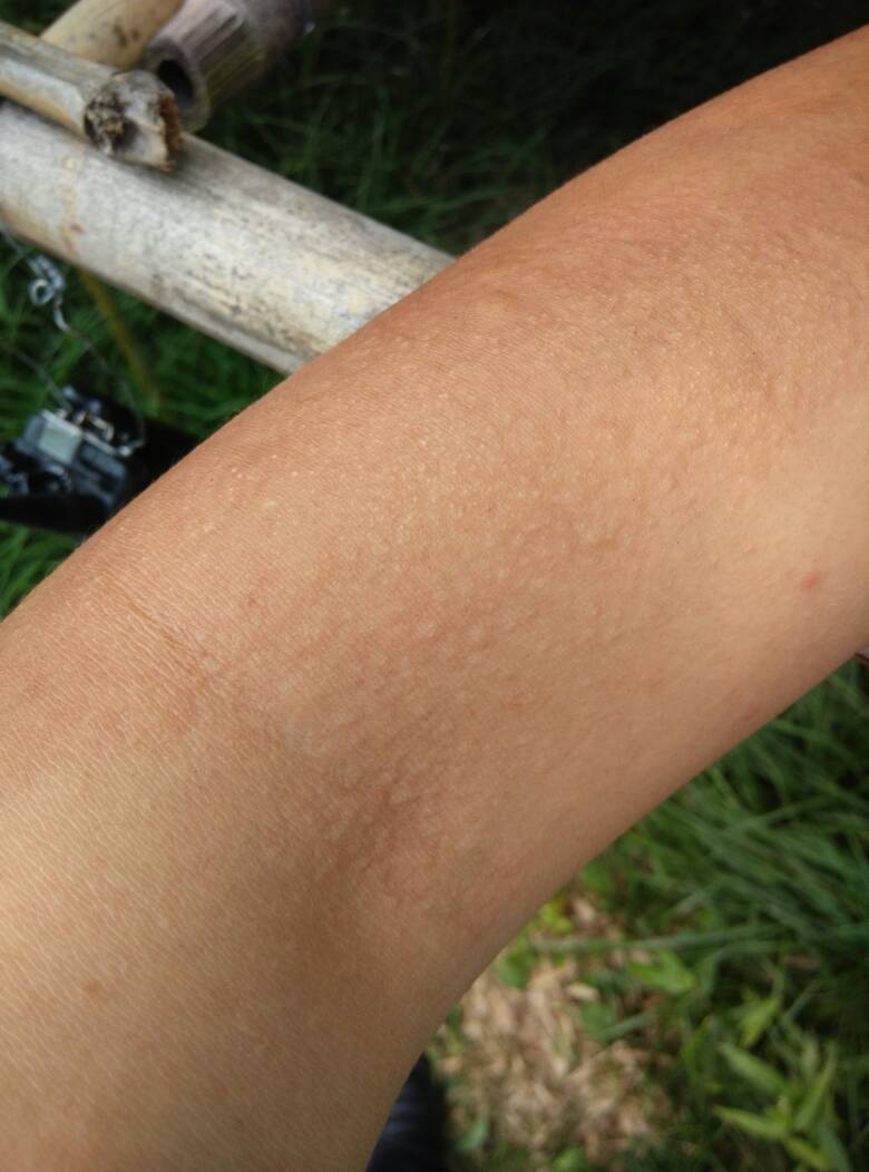 在“深入了解”前，如何判断对象有没有性病？医生：这几点要记住