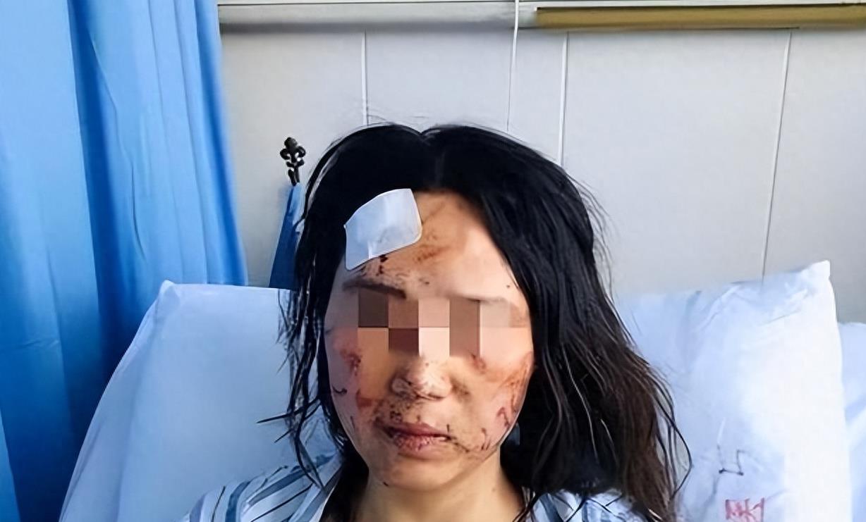 72小时不让睡觉，后背打到脱皮，女子恳求民警：他都是为我好