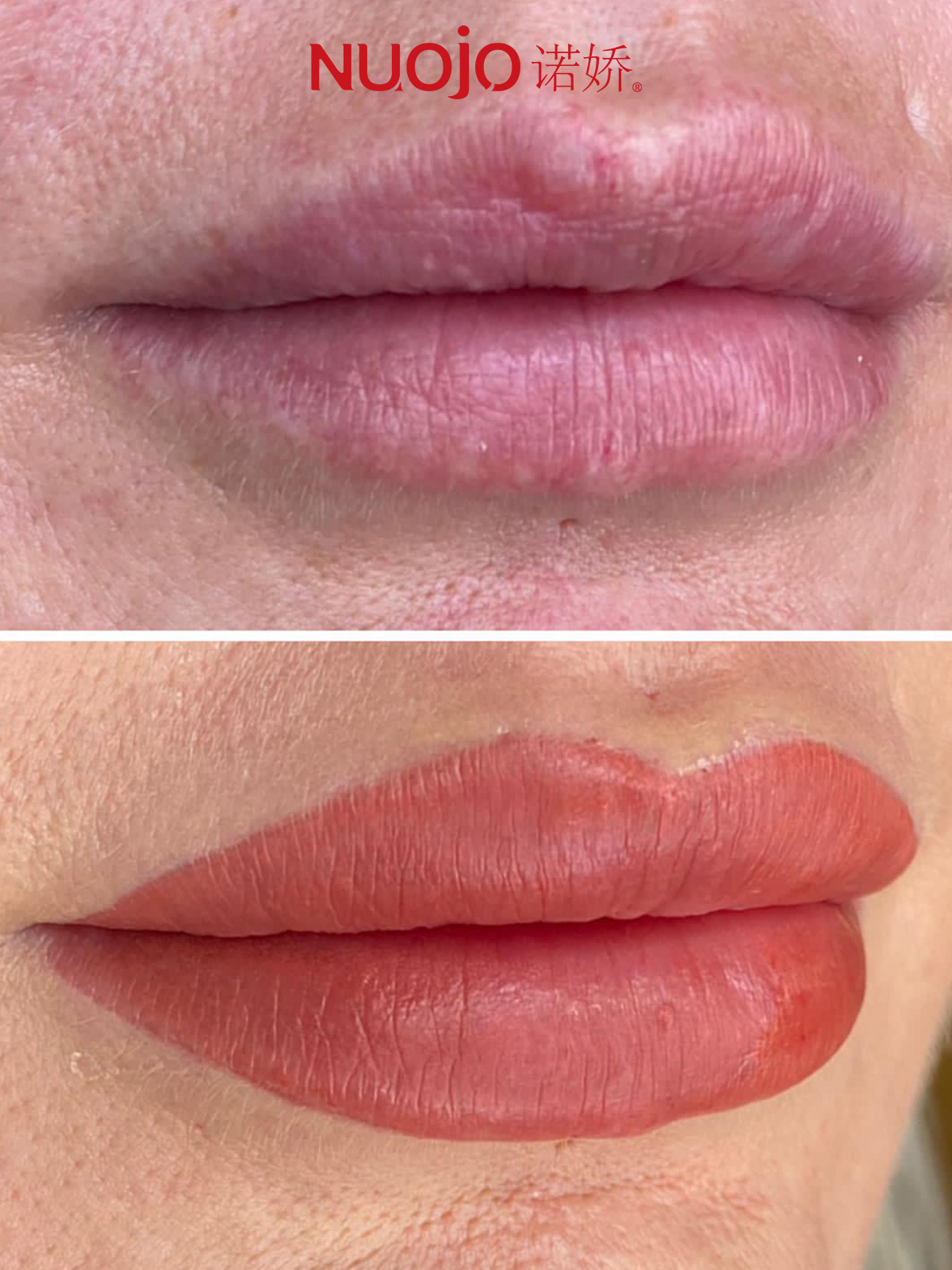 纹唇后期唇部发黑补色可以遮住吗,纹唇颜色发乌后期怎么补色