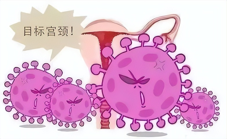 感染hpv导致宫颈癌还能治好吗,感染hpv导致癌变的几率