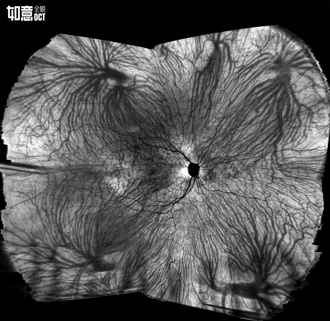 惠民眼科医院,惠民中心医院眼科
