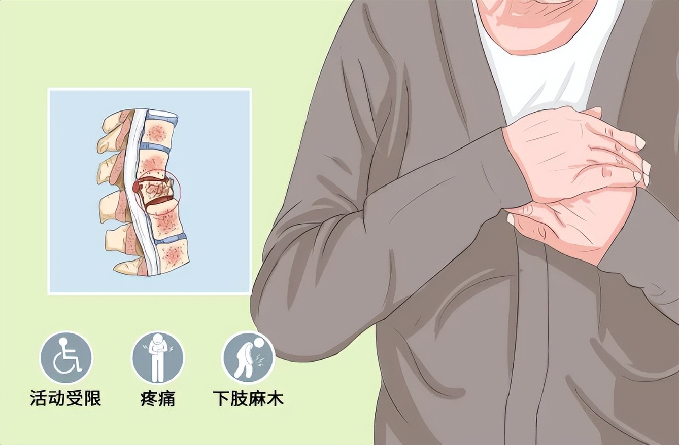 老年人骨质疏松腰椎骨折保守治疗,腰椎骨折保守治疗好了能弯腰不