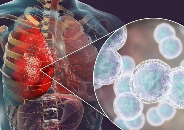 “阿莫西林”要了解，或对4种病有效，乱用、滥用或会引火烧身？