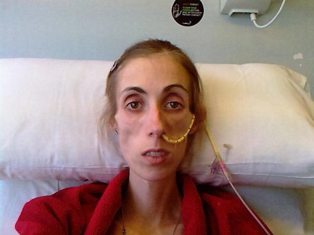 割阴切胃，挑断脚筋，甚至致人死亡，“畸形审美”有多猖狂