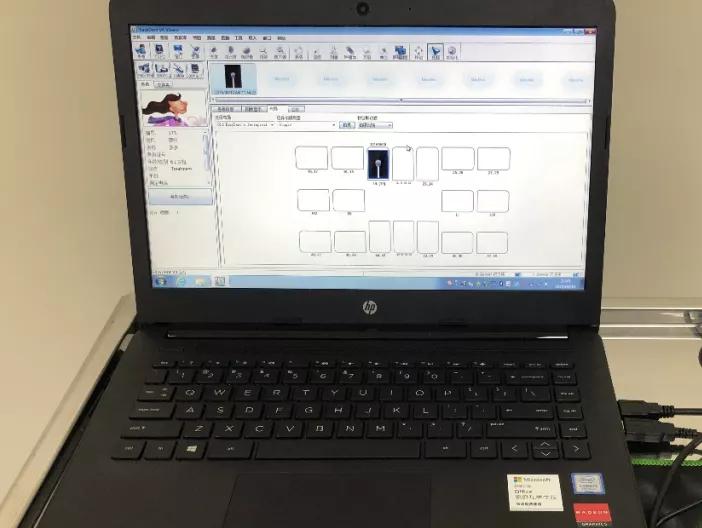 牙釉质发育不全能矫正吗,牙釉质发育不全怎么补救