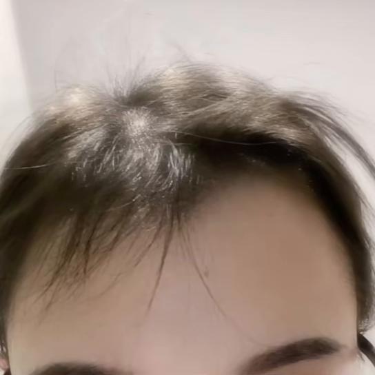 生姜洗发水真的有效防脱发吗,生姜洗发水真的能治脱发