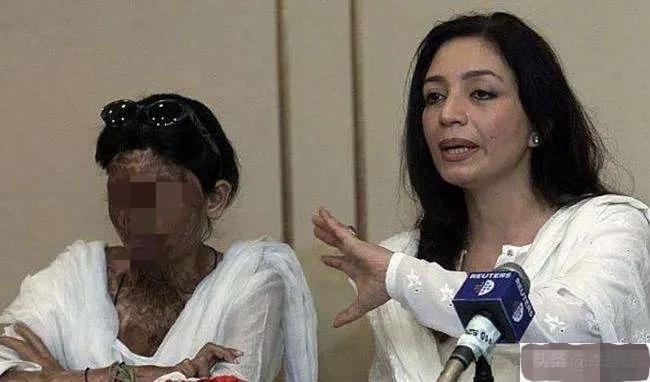 硫酸泼脸自救,硫酸泼到身上怎么自救