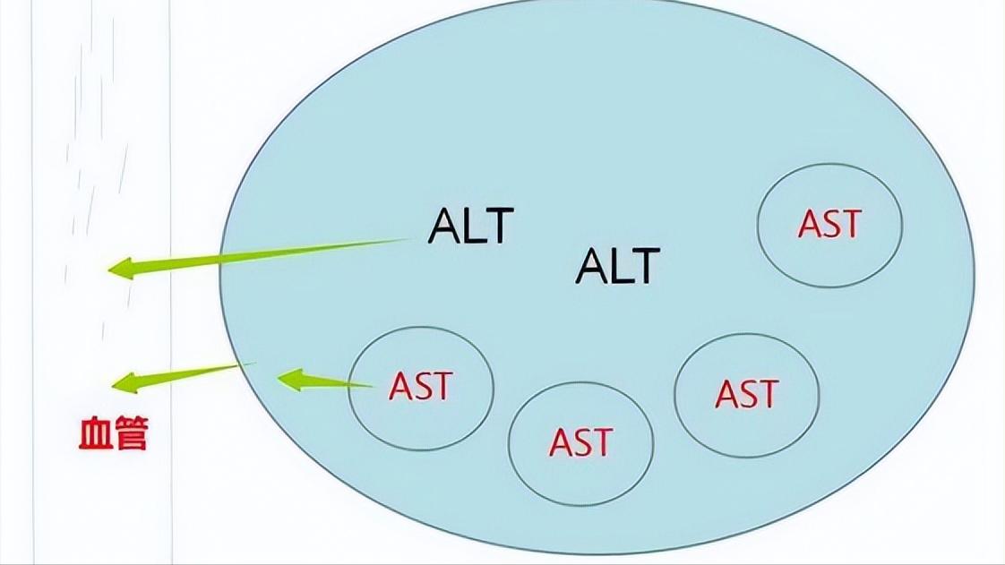 谷丙转氨酶高多少可以判定为肝癌,谷丙转氨酶偏高多少才是肝癌