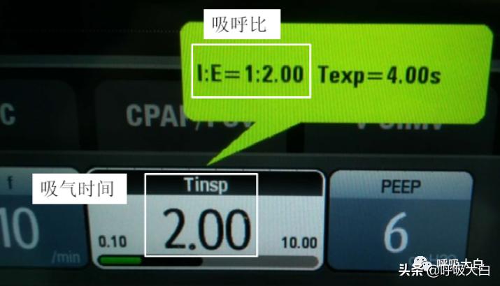 呼吸机设置：呼吸频率+吸呼比