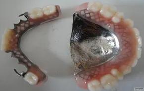 老年人牙齿治疗方案,老年人牙坏了很多怎么修才好