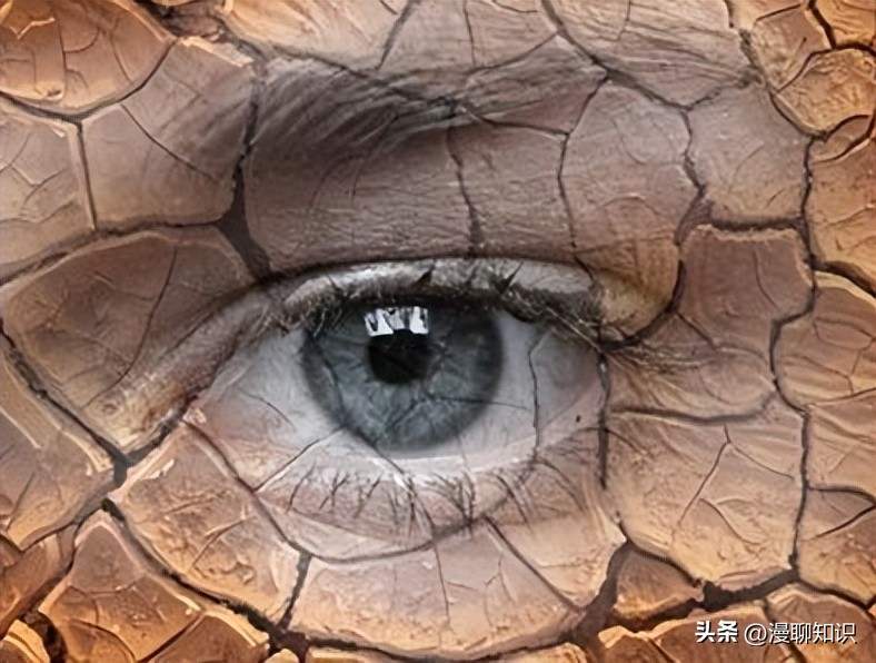 干眼就是干燥综合症吗,眼干涩视物模糊得了干眼怎么办