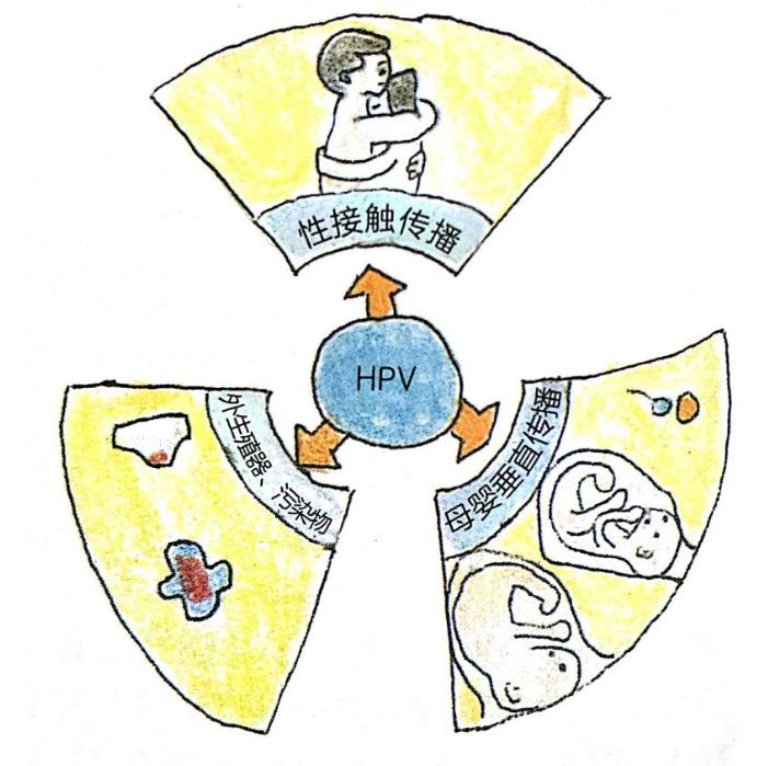 女性hpv阳性会影响怀孕吗,hpv35阳性能怀孕吗