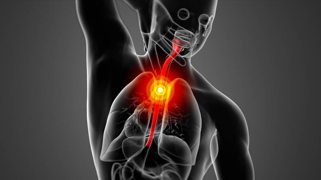 突然鱼刺卡喉，千万别再吞饭、喝醋了！医生教你正确的处理方法