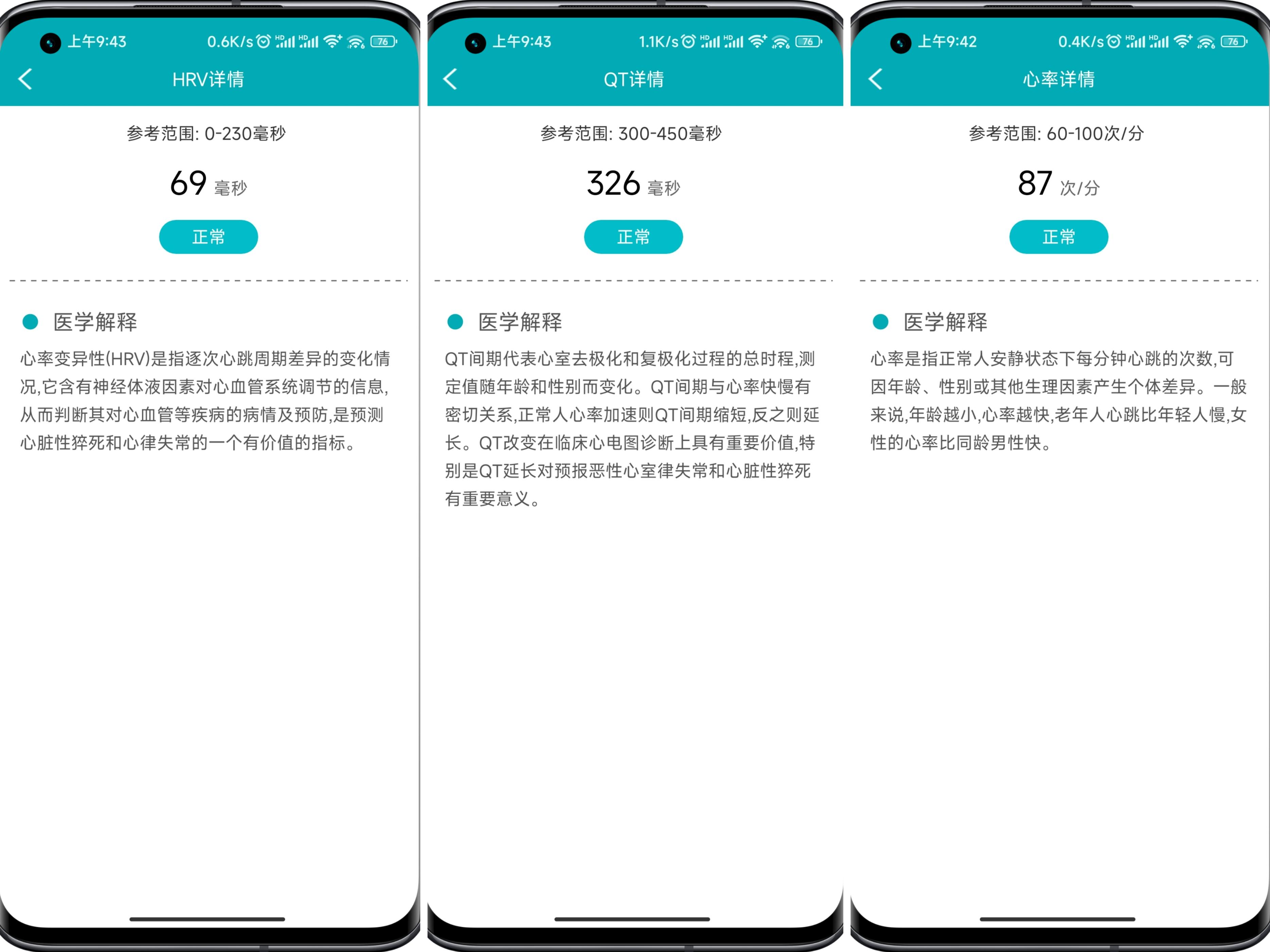 didoe55智能手表靠谱吗,dido智能手表哪款健康监测最好