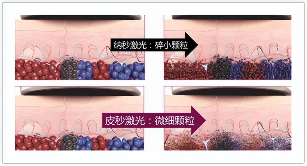 遮瑕色斑化妆的正确步骤教程,干性皮肤脸上有色斑怎么遮瑕