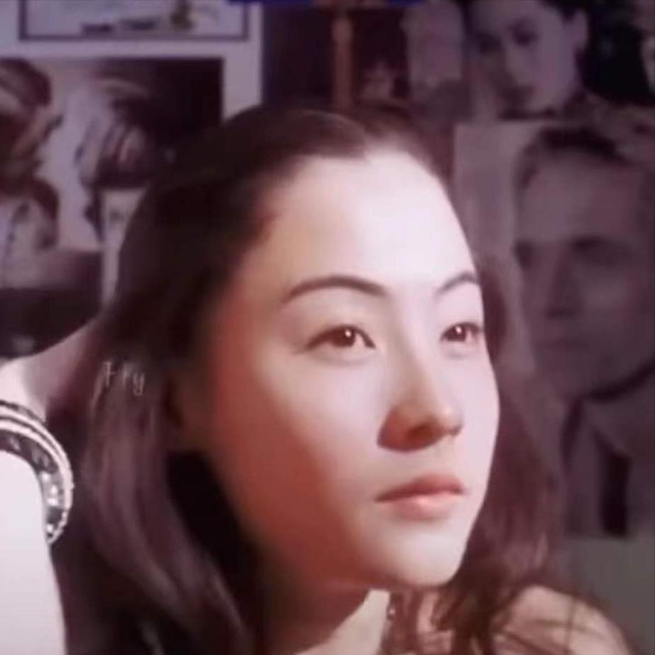 张柏芝被宠物狗咬脸,张柏芝小儿子受伤